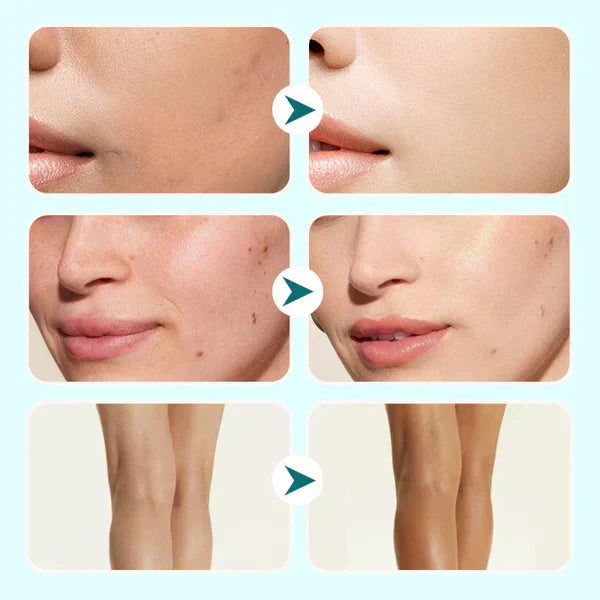 🔥Siste dag - kjøp 1 få 1 gratis!🎁Alt-i-ett fuktighetskrem, concealer og dekning 💧✨ Lett og vanntet